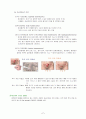 자궁근종 case study 7페이지
