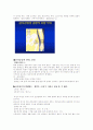 골다공증 ( osteoporosis ) 2페이지