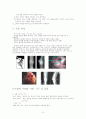퇴행성 관절염 8페이지