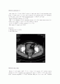 rectal cancer case report & colorectal cancer review 2페이지