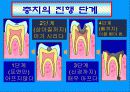 보건교육(충치예방) 13페이지