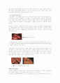에이즈에 대해 8페이지