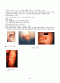 [논문] 신생아 건강사정 2페이지