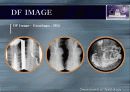 (Radiologic Technological Round)-디지털 의료 영상 7페이지