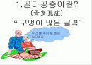 골다공증 분석-예방 및 치료 5페이지