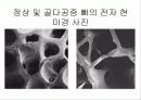 골다공증 분석-예방 및 치료 6페이지