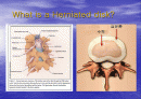 요통(Herniated disk)의 발생 원인과 증상 그리고 효과적인 치료방법 2페이지