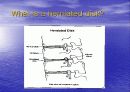 요통(Herniated disk)의 발생 원인과 증상 그리고 효과적인 치료방법 3페이지