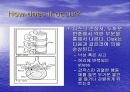 요통(Herniated disk)의 발생 원인과 증상 그리고 효과적인 치료방법 4페이지
