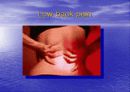 요통(Herniated disk)의 발생 원인과 증상 그리고 효과적인 치료방법 20페이지