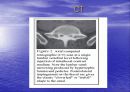 요통(Herniated disk)의 발생 원인과 증상 그리고 효과적인 치료방법 50페이지