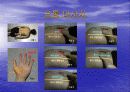 요통(Herniated disk)의 발생 원인과 증상 그리고 효과적인 치료방법 52페이지