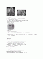 갈색세포종 Pheochromocytoma 3페이지