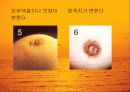 유방암의 증상과 진단, 치료 그리고 예방에 관한 이해 7페이지