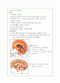 뇌수종(수두증-Hydrocephalus) 2페이지