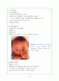 뇌수종(수두증-Hydrocephalus) 4페이지