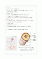 뇌수종(수두증-Hydrocephalus) 7페이지