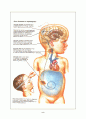 뇌수종(수두증-Hydrocephalus) 8페이지