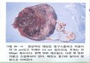 출산 29페이지