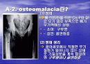 골다공증에 프리젠테이션을 위한 완벽 ppt자료! 8페이지