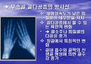 골다공증에 프리젠테이션을 위한 완벽 ppt자료! 20페이지