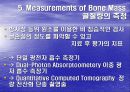골다공증에 프리젠테이션을 위한 완벽 ppt자료! 21페이지