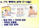 골다공증에 프리젠테이션을 위한 완벽 ppt자료! 28페이지