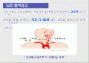 뇌혈관사고, 뇌졸중 7페이지