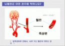 뇌혈관사고, 뇌졸중 10페이지