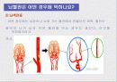 뇌혈관사고, 뇌졸중 11페이지
