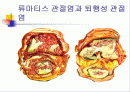 무릎 관절염의 진단과 치료 2페이지