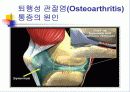 무릎 관절염의 진단과 치료 5페이지