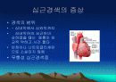 심근경색과 협심증 16페이지