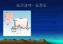 심근경색과 협심증 18페이지