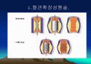 심근경색과 협심증 30페이지