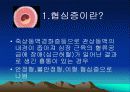 심근경색과 협심증 32페이지