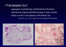 Idiopathic Interstitial Pneumonia 9페이지