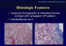 Idiopathic Interstitial Pneumonia 24페이지