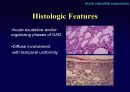 Idiopathic Interstitial Pneumonia 45페이지