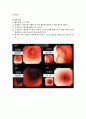 검사보고서(위내시경) 2페이지