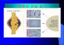 퇴행성 관절염 6페이지