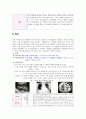 만성 신부전(사례연구) 5페이지