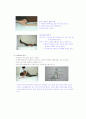 뇌졸증 환자간호(사례연구) 4페이지