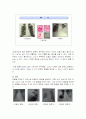 폐렴 문헌고찰(사례연구) 4페이지