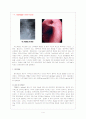 Esophageal diverticulum와 Aspiration pneumonia 환자의 간호 4페이지