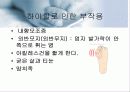 발과 건강 /보건위생 8페이지