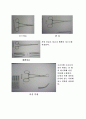 근치적 부분 위 절제술 (RSG; Radical subtotal gastrectomy) 11페이지