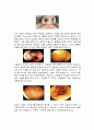 수술의 정의와 절차(30개정도 수술& 각각 그림포함 ) 16페이지