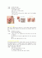 수술의 정의와 절차(30개정도 수술& 각각 그림포함 ) 54페이지