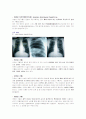 Case study - 기흉에 대한 Case study [CS] 3페이지